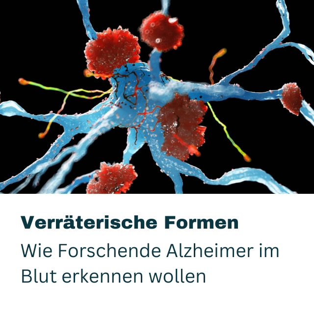 Verräterische Formen - Wie Formschende Alzheimer im Blut erkennen wollen